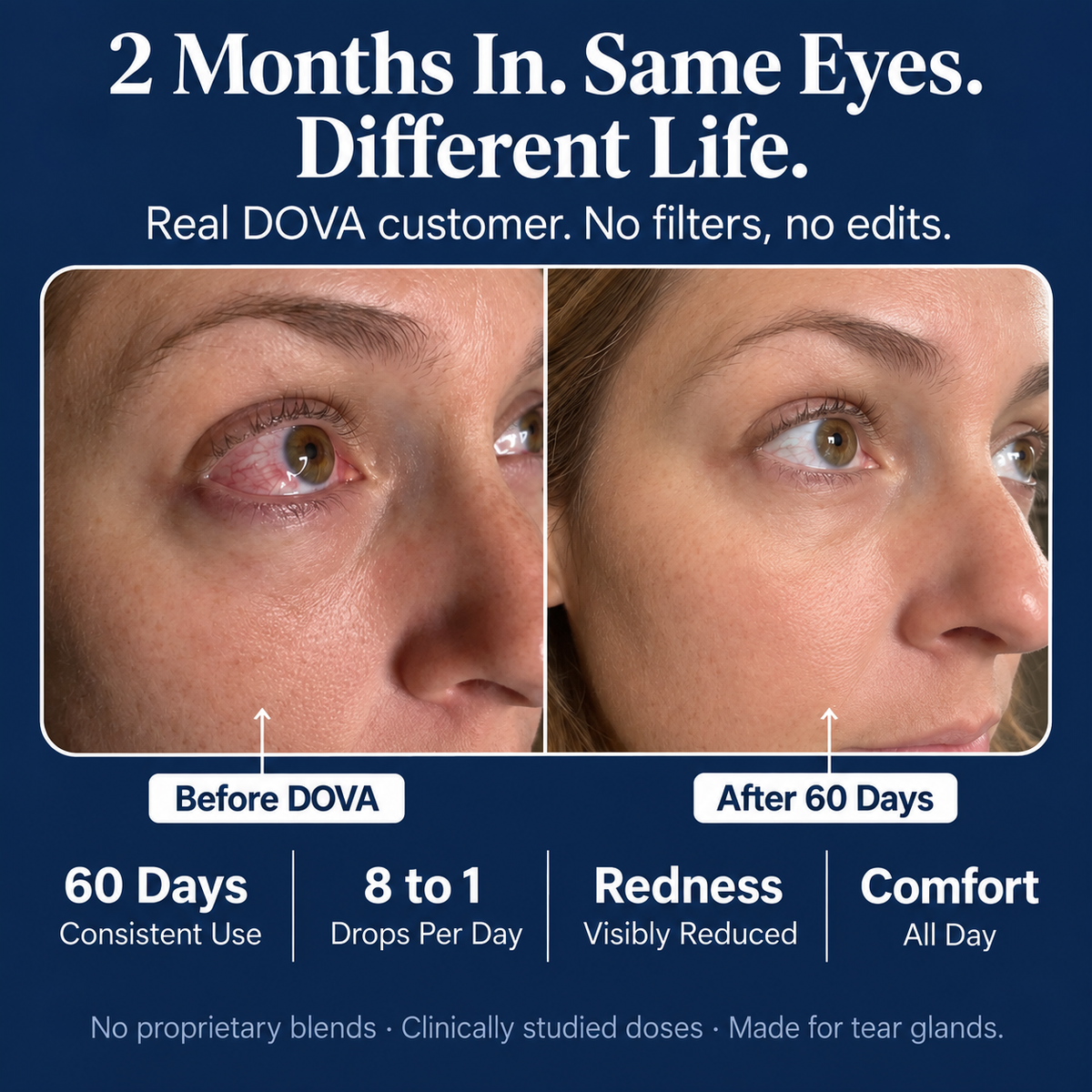 DryEye Repair